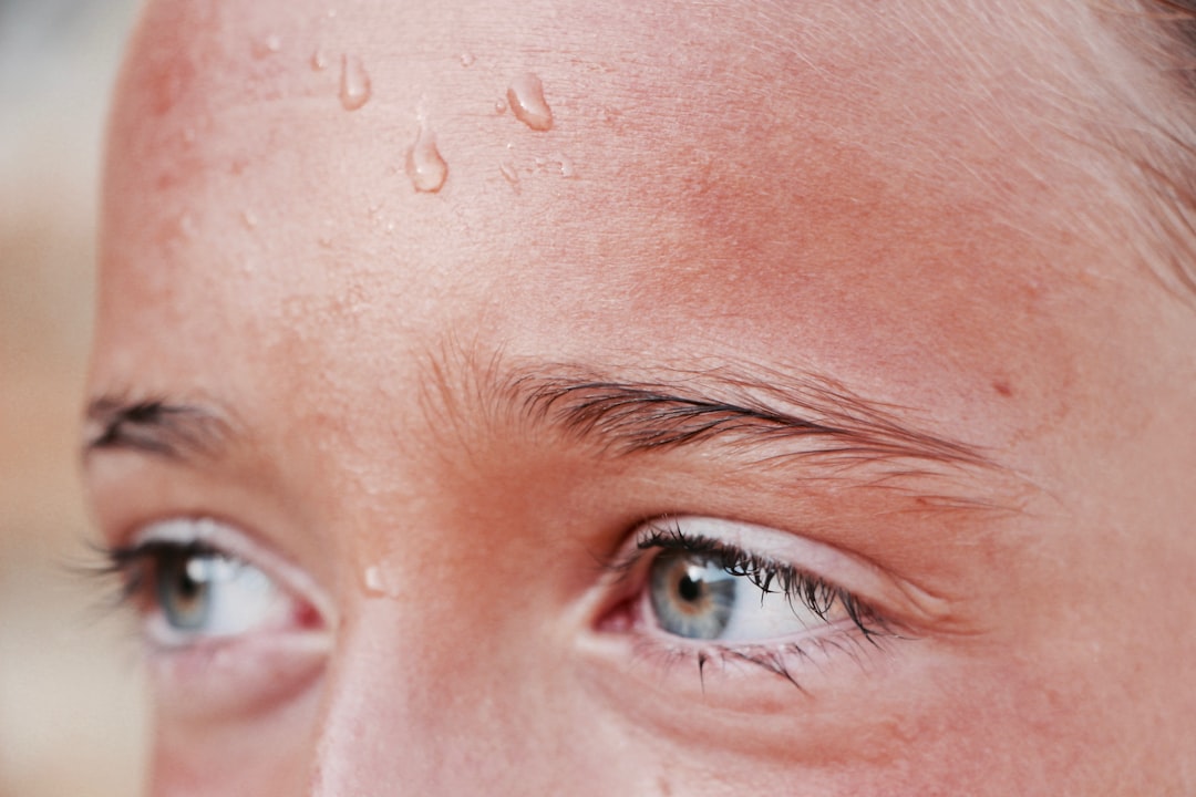 Photo acne prevention